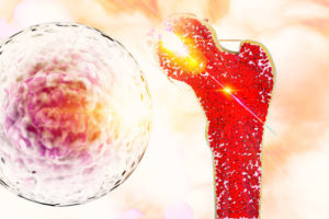 istockphoto 981887230 612x612 1